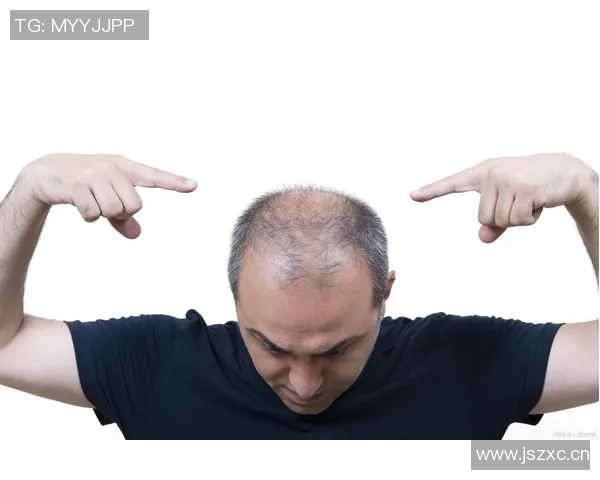 足球明星植发揭秘谁在为脱发烦恼重拾自信与风采 足球明星植发揭秘谁在为脱发烦恼重拾自信与风采